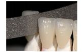 Диски алмазні стоматологічні - Штрипси 6 мм