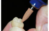 Поліри зуботехнічні - Полиры для PMMA&PEEK